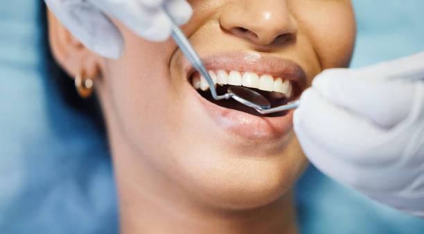 Best Emergency Root Canal Treatment in Winchester, IL